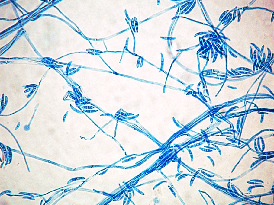 Fusarium proliferatum